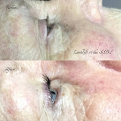facial treatments training courses