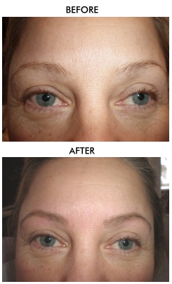 Eyebrow Enhancement Training Course